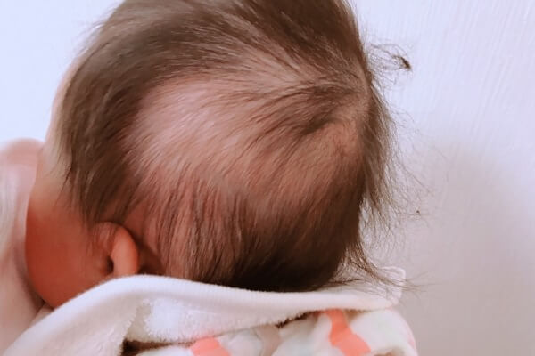 赤ちゃんの後頭部にある毛の絡まり ルカコ 育児をおしゃれにスマートに