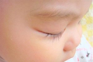 赤ちゃんの目やにについて
