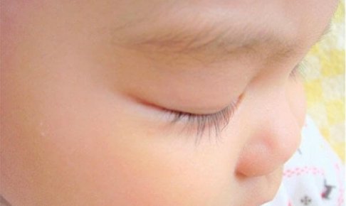 赤ちゃんの目やにについて
