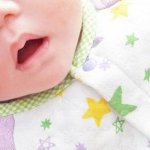 赤ちゃんの唇にできる「吸いだこ」