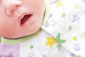 赤ちゃんの唇にできる「吸いだこ」