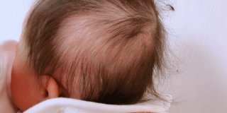 赤ちゃんの後頭部にある毛の絡まり ルカコ 育児をおしゃれにスマートに